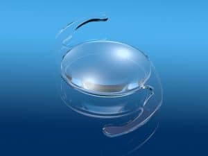 Refractive Lens Exchange in Scottsdale