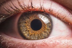 Corneal Disease in Scottsdale 